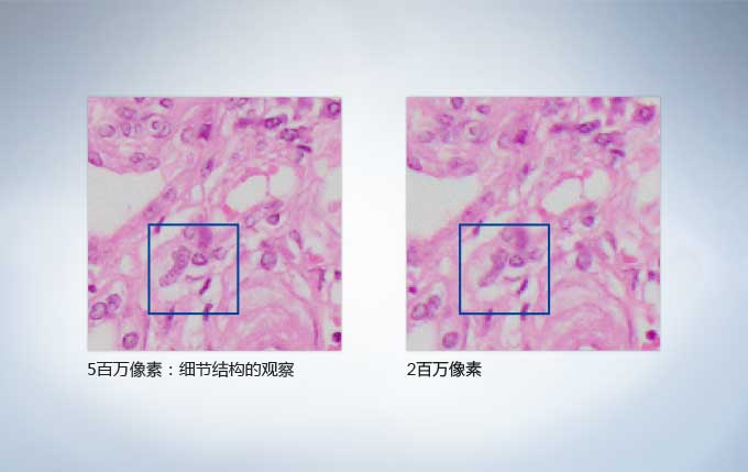 奧林巴斯顯微鏡 奧林巴斯顯微鏡