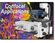 奧林巴斯顯微鏡激光共聚焦的應(yīng)用